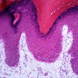 Histology slide of human skin, epidermis and dermis